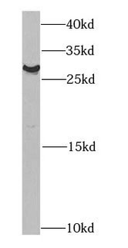 CHMP2B Rabbit Polyclonal Antibody