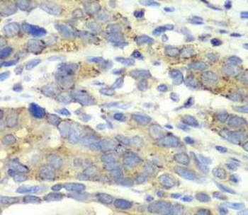 CHMP2B Rabbit Polyclonal Antibody