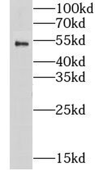 CHRNA1 Rabbit Polyclonal Antibody