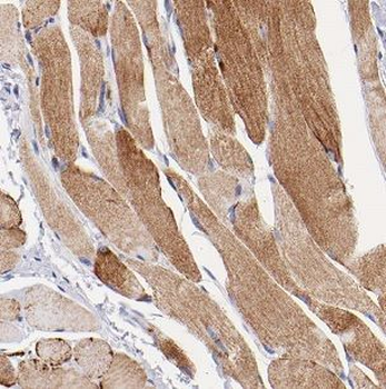 CHRNA1 Rabbit Polyclonal Antibody