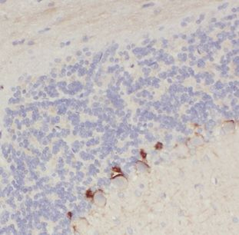 CHRNB3 Rabbit Polyclonal Antibody