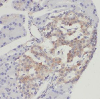 CHGB Rabbit Polyclonal Antibody