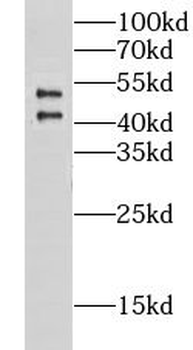 CHST9 Rabbit Polyclonal Antibody