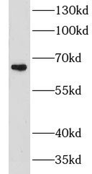 CHSY1 Rabbit Polyclonal Antibody