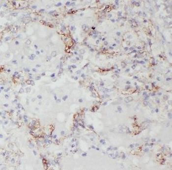 CHSY1 Rabbit Polyclonal Antibody