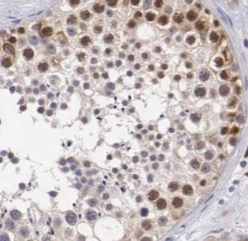 BIRC2 Rabbit Polyclonal Antibody