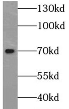 BIRC3 Rabbit Polyclonal Antibody