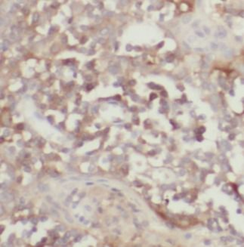 BIRC3 Rabbit Polyclonal Antibody