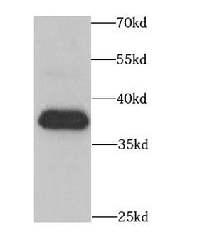 CIAPIN1 Rabbit Polyclonal Antibody