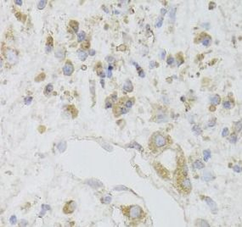 CIAPIN1 Rabbit Polyclonal Antibody