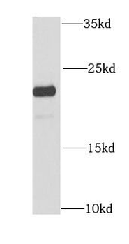 CIB1 Rabbit Polyclonal Antibody
