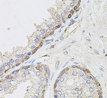 CIB1 Rabbit Polyclonal Antibody