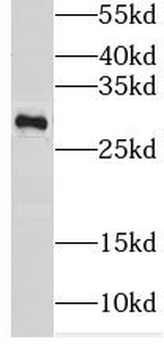 SARNP Rabbit Polyclonal Antibody