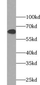 CKAP4 Rabbit Polyclonal Antibody