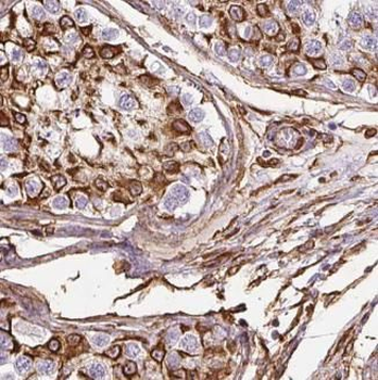 CLDN11 Rabbit Polyclonal Antibody