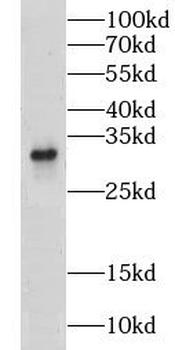 CLEC1A Rabbit Polyclonal Antibody