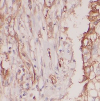 CLEC1A Rabbit Polyclonal Antibody