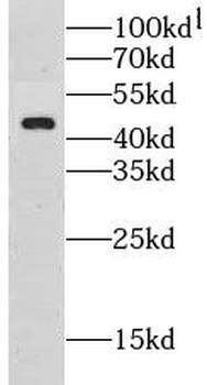 CLEC4M Rabbit Polyclonal Antibody