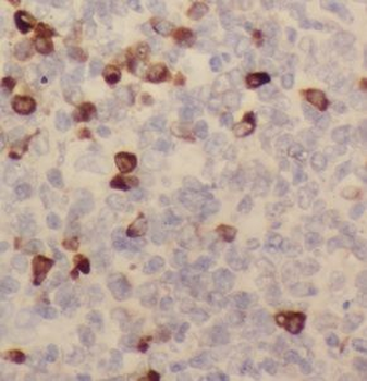 CLEC4M Rabbit Polyclonal Antibody