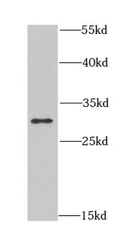 CLIC1 Rabbit Polyclonal Antibody