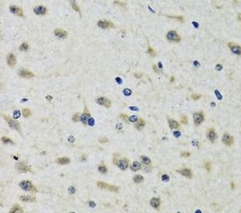 CLIC1 Rabbit Polyclonal Antibody