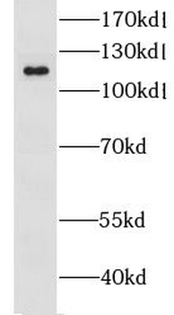 CLIP2 Rabbit Polyclonal Antibody