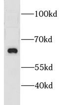 CNKSR3 Rabbit Polyclonal Antibody