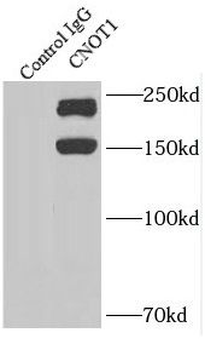 CNOT1 Rabbit Polyclonal Antibody