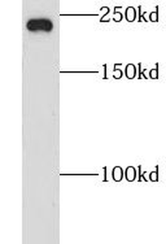CNOT1 Rabbit Polyclonal Antibody