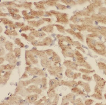 CNOT1 Rabbit Polyclonal Antibody