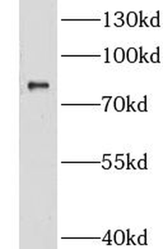 CNOT10 Rabbit Polyclonal Antibody
