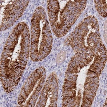 CNOT10 Rabbit Polyclonal Antibody
