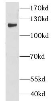 CNOT3 Rabbit Polyclonal Antibody