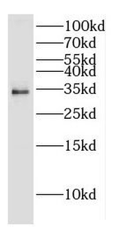 CNOT7 Rabbit Polyclonal Antibody