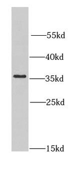 CNOT8 Rabbit Polyclonal Antibody