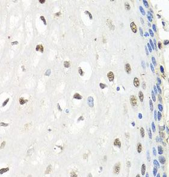 CNOT8 Rabbit Polyclonal Antibody