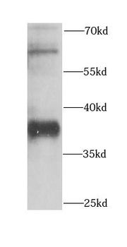 CNPY3 Rabbit Polyclonal Antibody