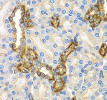 CNPY3 Rabbit Polyclonal Antibody