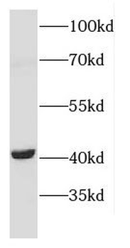 CNTFR Rabbit Polyclonal Antibody