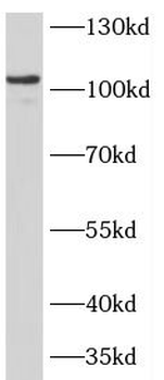 COG1 Rabbit Polyclonal Antibody