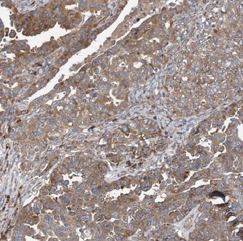 COG1 Rabbit Polyclonal Antibody