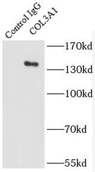 Collagen Type III Rabbit Polyclonal Antibody