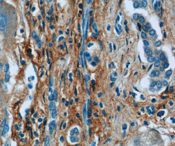 Collagen Type III Rabbit Polyclonal Antibody
