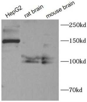 Collagen Type III Rabbit Polyclonal Antibody