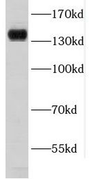 COL6A2 Rabbit Polyclonal Antibody