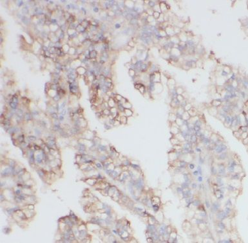 COL6A2 Rabbit Polyclonal Antibody