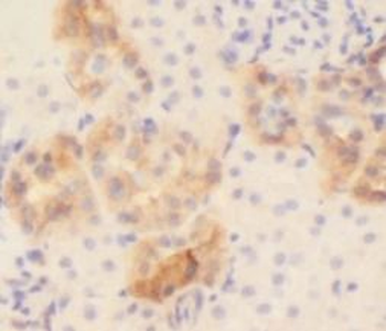 COL6A1 Rabbit Polyclonal Antibody