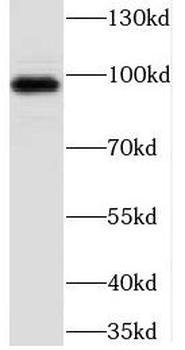 CFB Rabbit Polyclonal Antibody