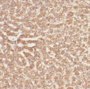 CFB Rabbit Polyclonal Antibody