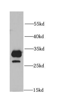 COMT Rabbit Polyclonal Antibody